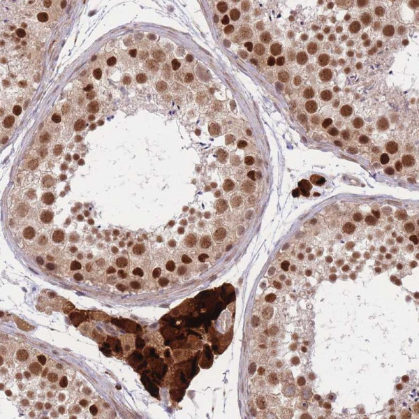 Anti-ERCC2