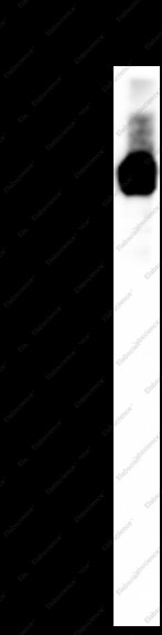 Anti-Recombinant HDAC5 (Phospho Ser498), clone C172063