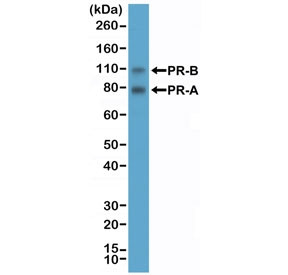 Anti-PR / Progesterone Receptor (recombinant antibody), clone RM357