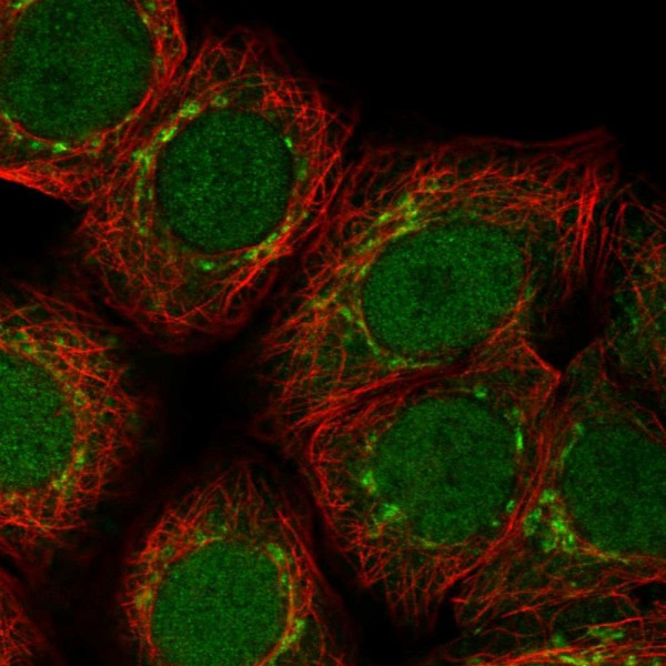 Anti-ARFIP1
