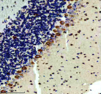 Anti-RAPGEF4 / EPAC 2, clone 22R17