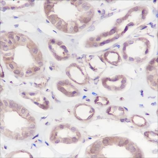 Anti-Recombinant Calpain small subunit 1, clone A148