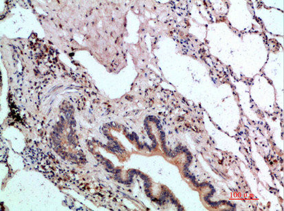 Anti-ASCL1