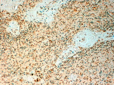 Anti-TET2, Internal