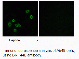 Anti-BRP44L