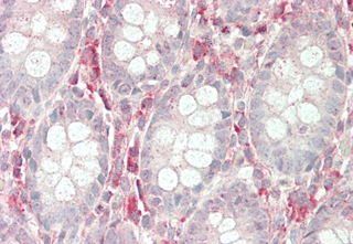 Anti-Ribosomal Protein S3 (human)