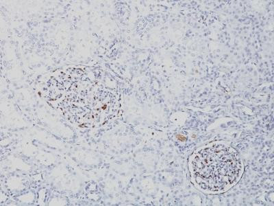 Anti-Wilm&#039;s Tumor 1 (WT1) (Wilm&#039;s Tumor &amp; Mesothelial Marker)(Clone: SPM361)