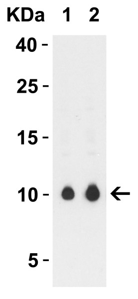Anti-SARS-CoV-2 ORF9c