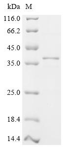 Deoxyribonuclease gamma (Dnase1l3), partial, mouse, recombinant