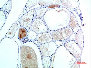 Anti-TTR Monoclonal