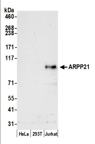 Anti-ARPP21