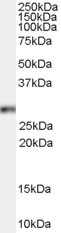 Anti-HOXB13, C-terminal