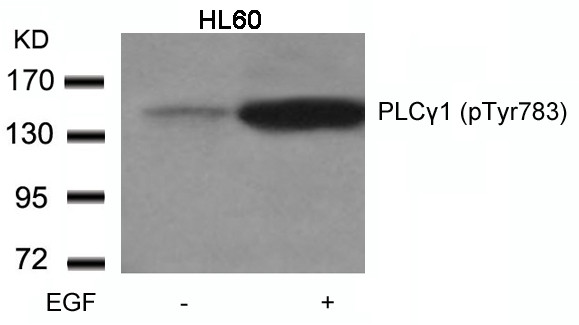 Anti-phospho-PLC gamma1 (Tyr783)