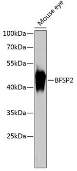 Anti-BFSP2