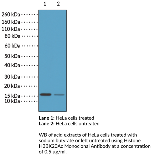 Anti-Histone H2BK20Ac Monoclonal Antibody (Clone RM235)