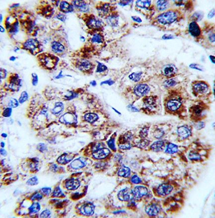Anti-OTC / Ornithine Carbamoyltransferase