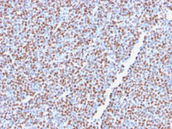 Anti-ALK / Anaplastic Lymphoma Kinase, clone ALK1/2766R