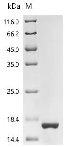 Sal-like protein 4 (SALL4), partial, recombinant human