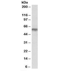 Anti-ADRA1B