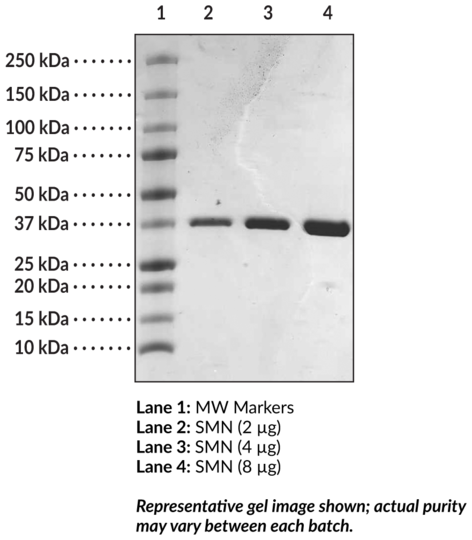 SMN tudor domain (human recombinant)