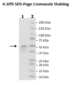 FGFR3 (N540K) His-Tag (Dephosphorylated)