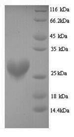 Ribosyldihydronicotinamide dehydrogenase [quinone] (Nqo2), mouse, recombinant