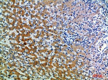 Anti-CD109