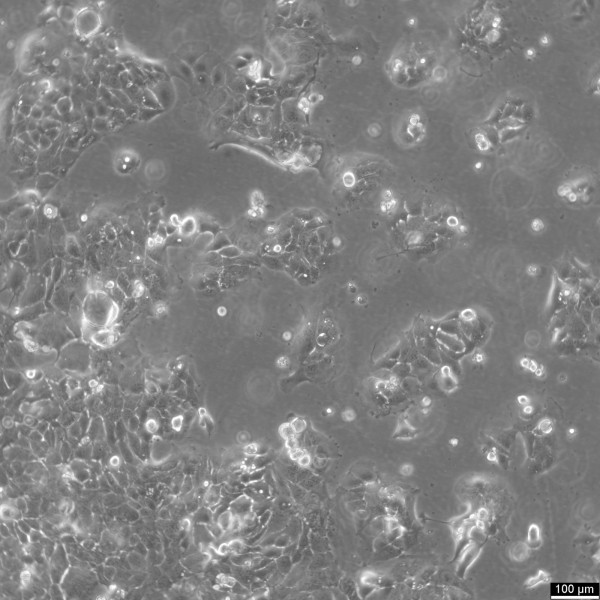 HT-1376 Cells