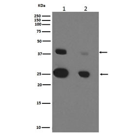 Anti-CTSD / Cathepsin D, clone CEF-3
