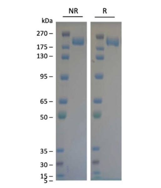 Spike Trimer (S1+S2) (XBB, Omicron Variant), His-Tag (SARS-CoV-2) Recombinant