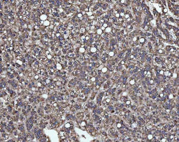 Anti-SLU7 / Pre-mRNA-splicing factor SLU7