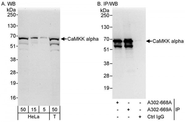 Anti-CaMKK alpha