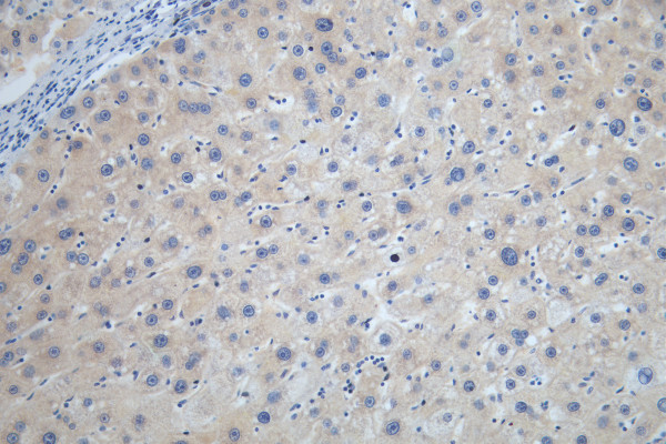 Anti-STK33 Recombinant Monoclonal, clone 5H11