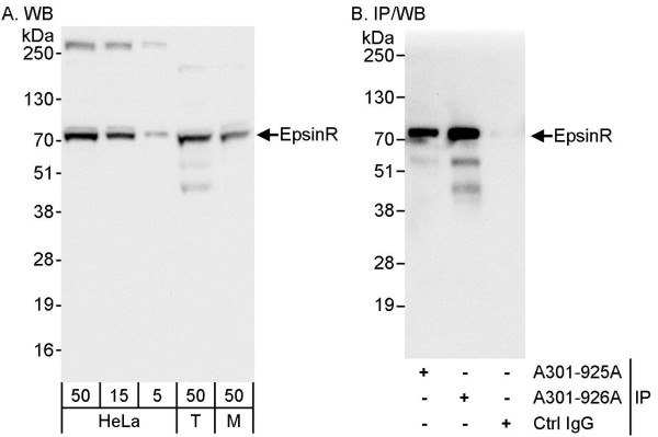Anti-EpsinR