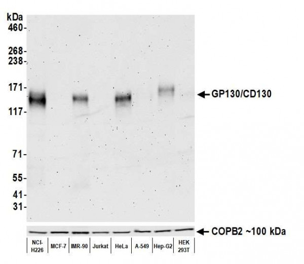 Anti-GP130/CD130 Recombinant Monoclonal