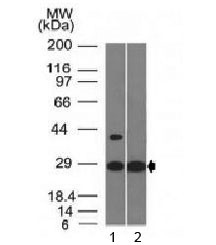 Anti-Erythropoietin / EPO, clone EPO/1368