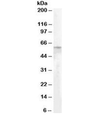 Anti-Adipose triglyceride lipase