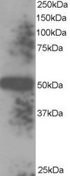 Anti-EndoPDI / TXNDC5, C-terminal