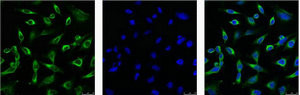 Anti-PRDX1 Monoclonal