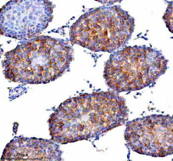 Anti-STAMBP / STAM-binding protein