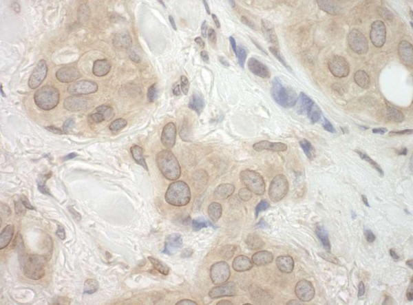 Anti-CASC3 (IHC)