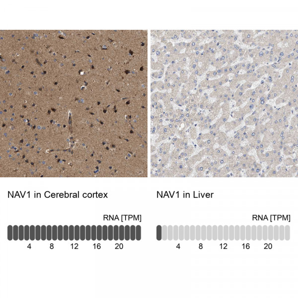 Anti-NAV1