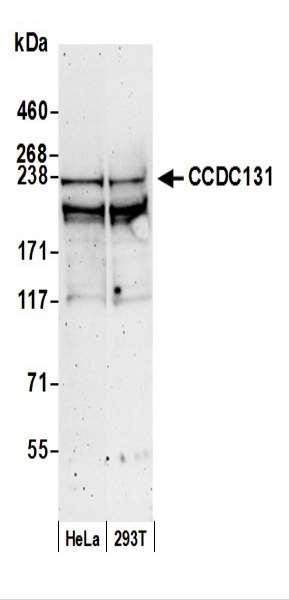 Anti-CCDC131