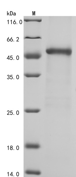 Coagulation factor XIII B chain (F13B), partial, human, recombinant