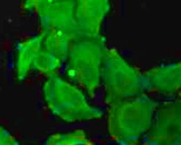Anti-CCT4 / TCP1 delta
