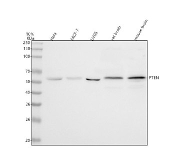 Anti-PTEN / Phosphatase and tensin