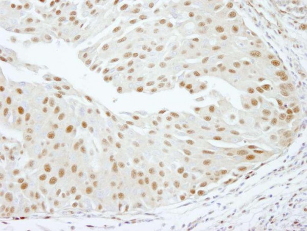 Anti-RBM16 IHC Antibody, affinity purifie (IHC)