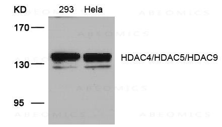 Anti-HDAC4/HDAC5/HDAC9 (Ab-246/259/220)
