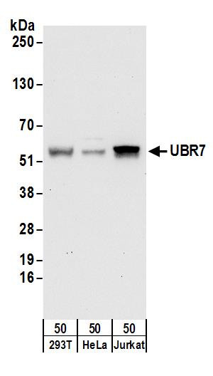 Anti-UBR7