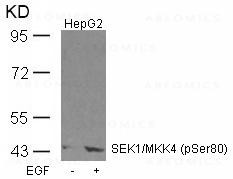 Anti-phospho-SEK1/MKK4 (Ser80)